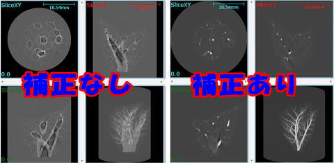 X線CTのフォーカシング